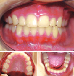 Orthodontic Specialists After