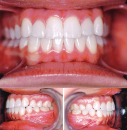 Orthodontic Specialists After