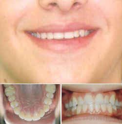 Orthodontic Specialists After