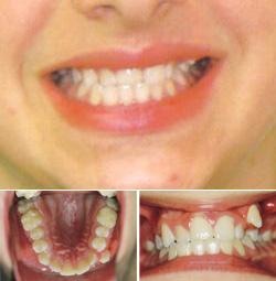 Orthodontic Specialists Before