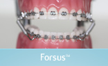 Forsus