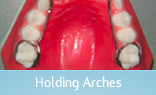 Holding Arches